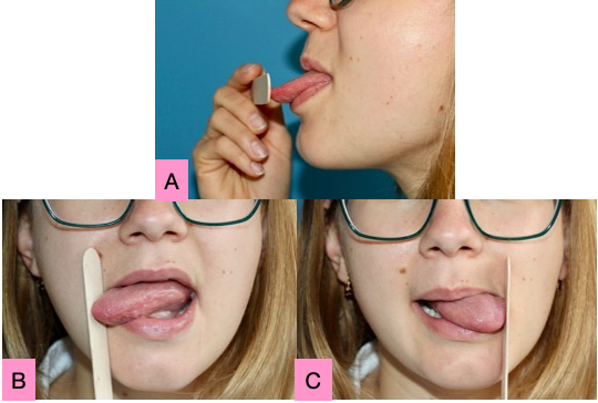 L’appui de la pointe et des faces latérales de la langue sur un abaisse-langue